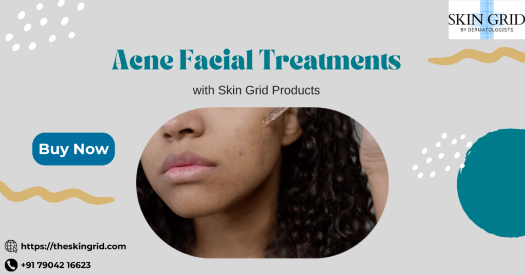 Acne Facial Treatment in Chennai & Kanchipuram